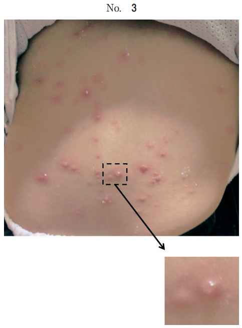102回看護師国家試験午前問題75