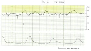 107回看護師試験午前問題117