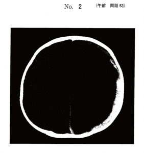 107回看護師試験午前問題53
