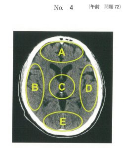 107回看護師試験午前問題72