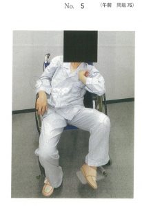 107回看護師試験午前問題76