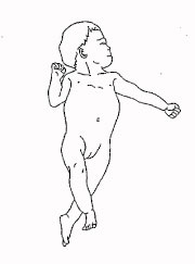 93回看護師国家試験午後問題70