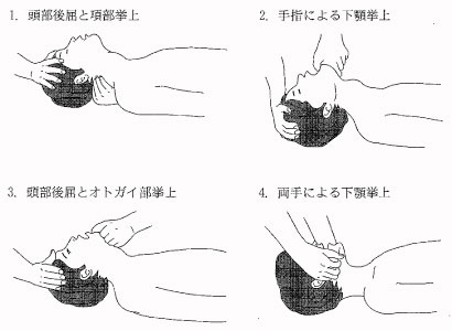 95回看護師国家試験午前問題63