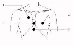 97回看護師国家試験午前問題30