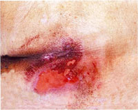 98回看護師国家試験午前問題40