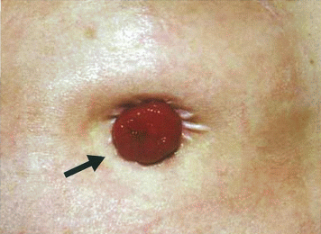 99回看護師国家試験午前問題20
