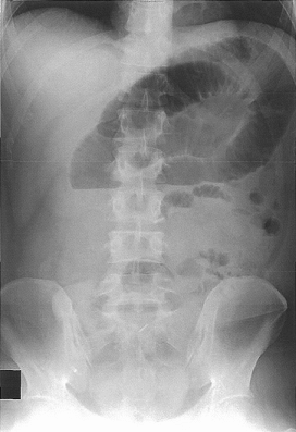 99回看護師国家試験午前問題84