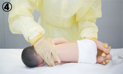 101回看護師国家試験午前問題67_4