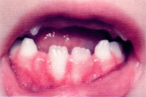 第26回歯科衛生士国家試験問題午後画像89