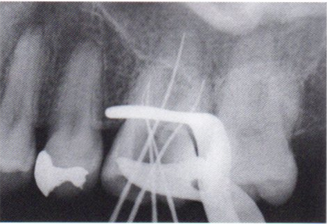 第27回歯科衛生士国家試験問題写真101