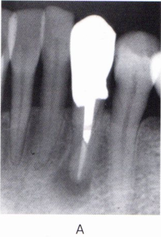 第27回歯科衛生士国家試験問題写真41a