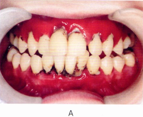 第27回歯科衛生士国家試験問題写真43a