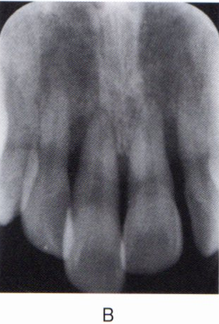 第27回歯科衛生士国家試験問題写真43b