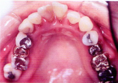 第27回歯科衛生士国家試験問題写真44