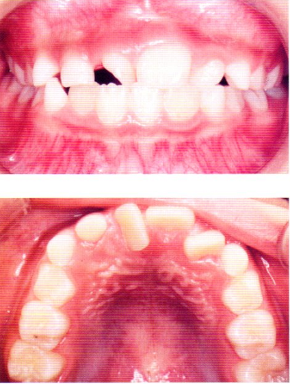 第27回歯科衛生士国家試験問題写真53