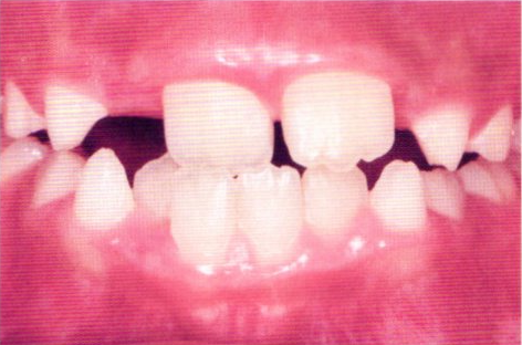 第27回歯科衛生士国家試験問題写真54