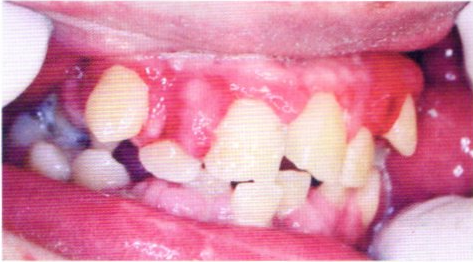 第27回歯科衛生士国家試験問題写真6162