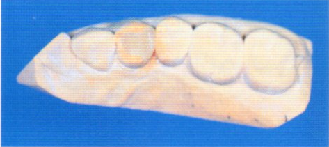 第27回歯科衛生士国家試験問題写真99