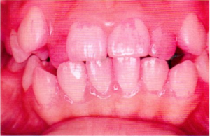 第25回歯科衛生士国家試験問題午後画像84-85